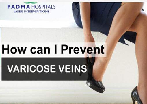 Prevent Varicose Veins in Miyapur, Hyderabad
