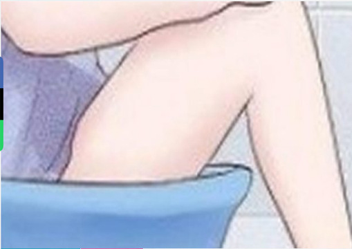 Sitzbath for Hemorrhoids